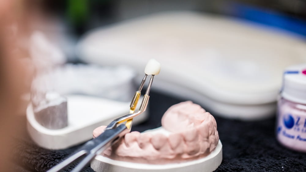 A dental technician carefully holds a crafted dental crown using tweezers over a model of teeth in a professional laboratory