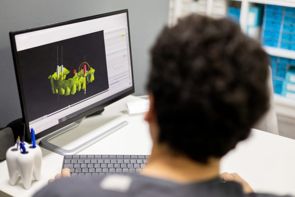 An unrecognizable dentist shows an implant surgery plan on his office monitor through a 3D X-ray. 3D implantology concept.