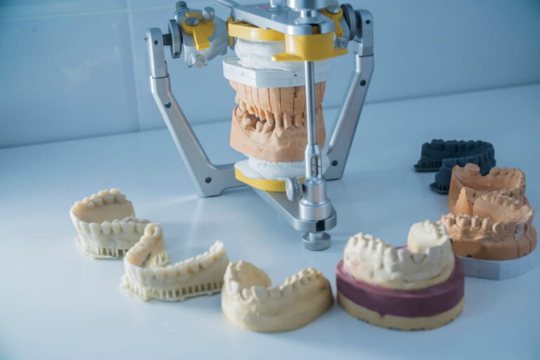 a set of dental casts