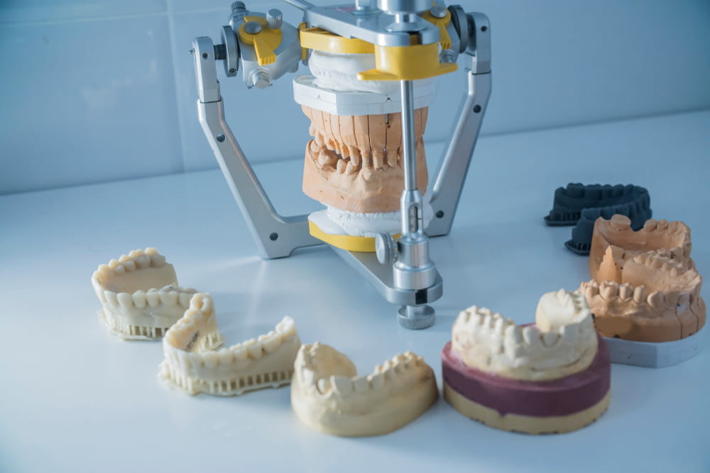 a set of dental casts