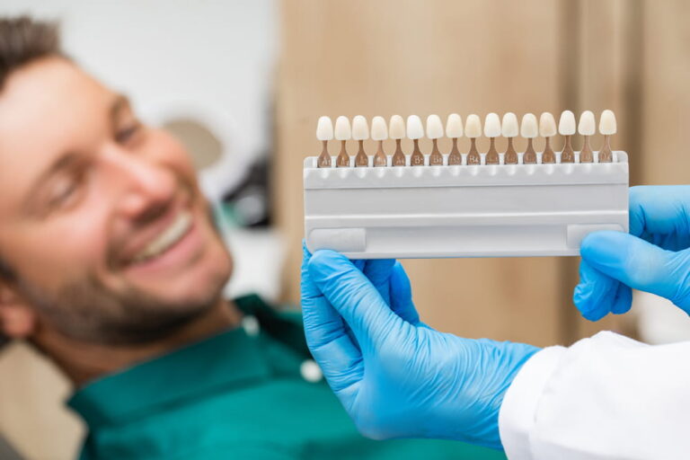 palette tooth color sample to determine shade over patient's teeth. Stomatologist will uses color of teeth to make veneers, crowns, and dentures