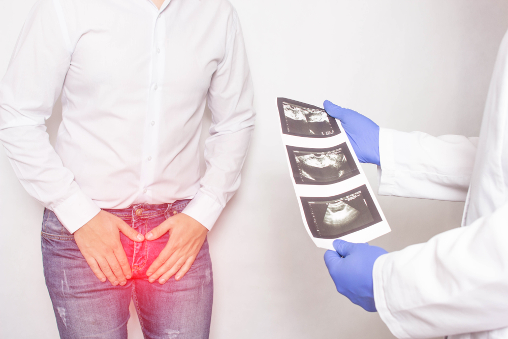 consultation with a urologist doctor who is holding ultrasound diagnostic images