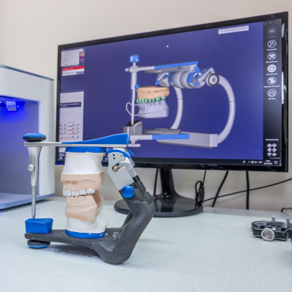 3D scanner and PC in the process of creating denture