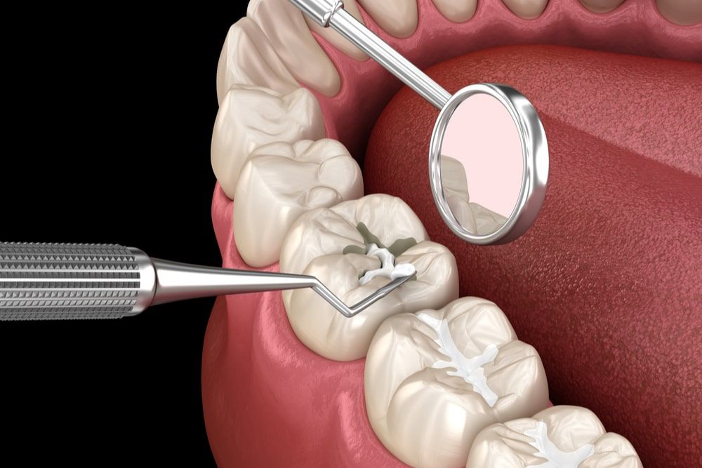 Medically accurate tooth 3D illustration