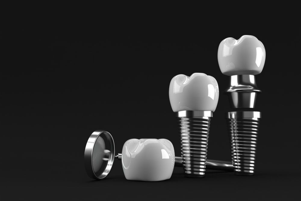 Dental Implants surgery concept 3D Rendering.