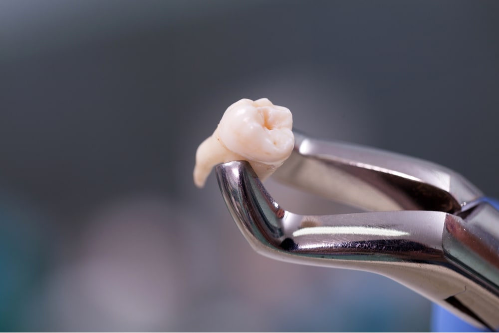 Dental equipment holding an extracted tooth