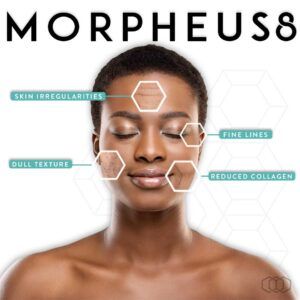 morpheus8-infographic-instagram-post-black-hair-preview-1