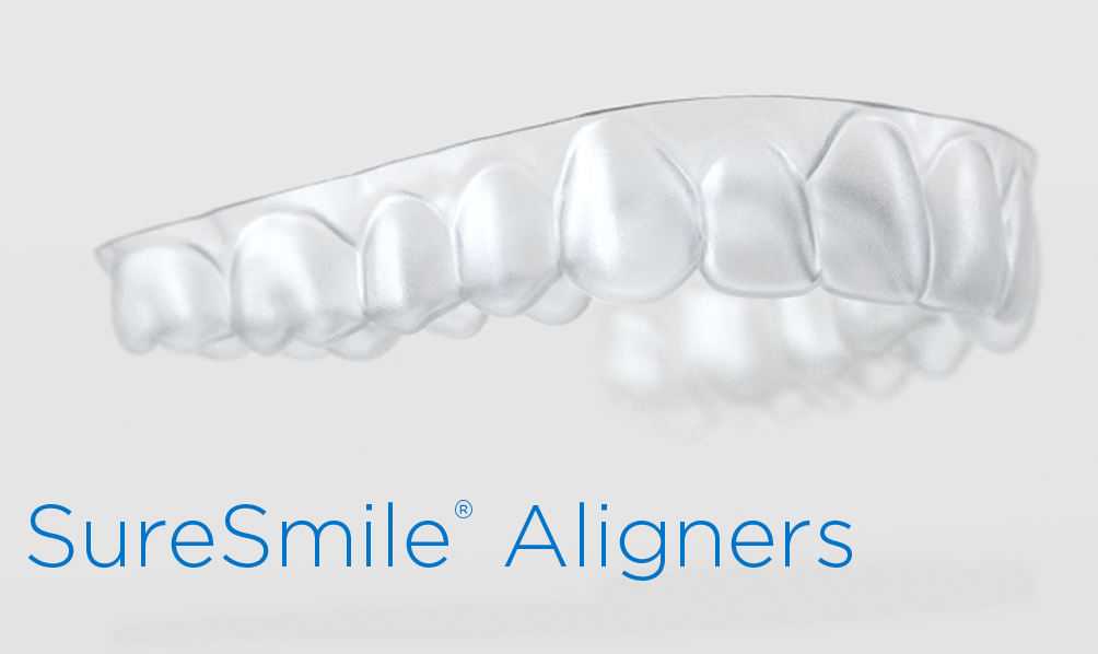 SureSmile aligners