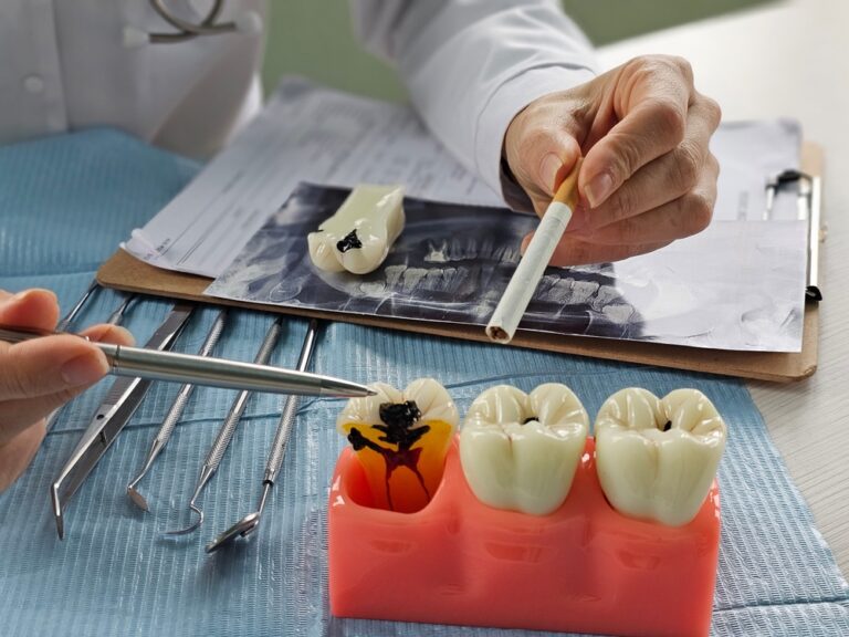 Dentist shows teeth with caries