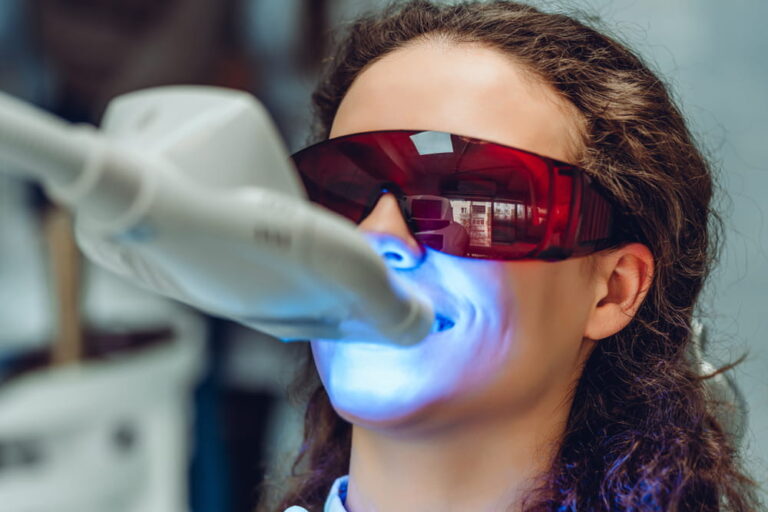Young woman whiten teeth at the dentist. Close up view.