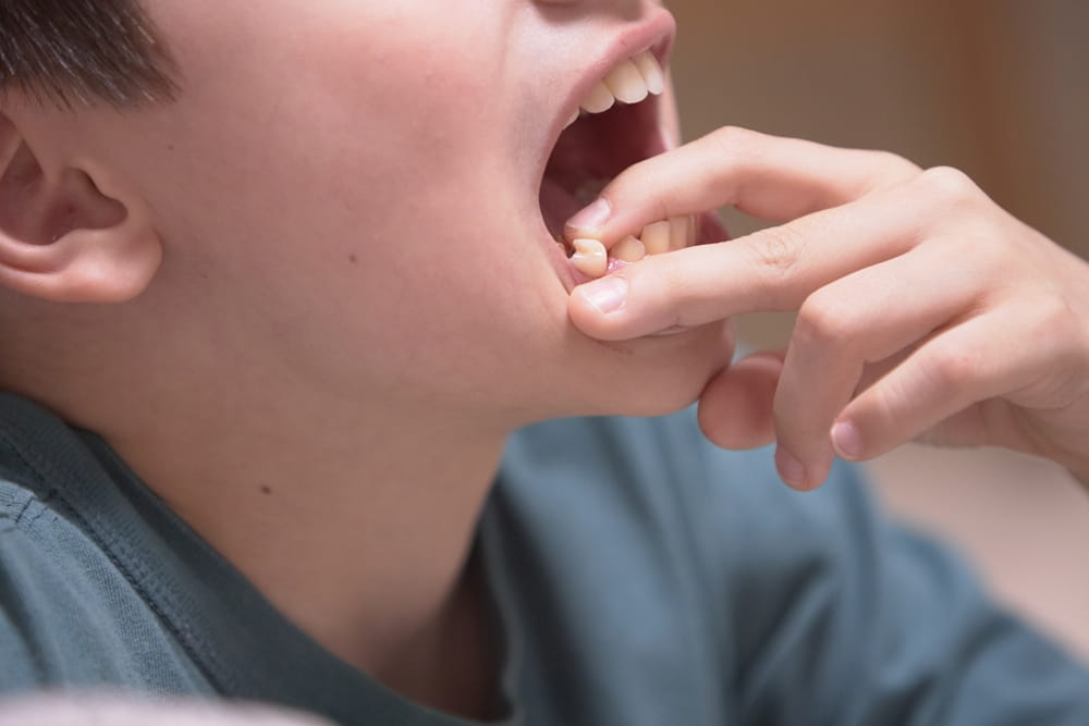 A boy's tooth falls out of his mouth in close-up