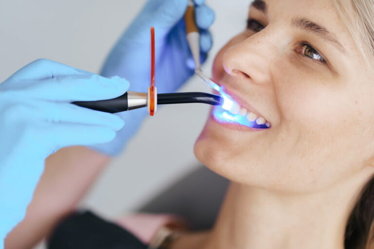 Photopolymer, dentist fixes a seal to a young patient woman, photopolymer lamp
