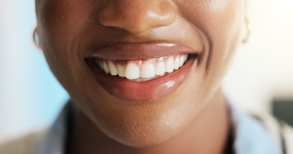 Dental hygiene, mouth and woman with smile, wellness and remove plaque with teeth whitening