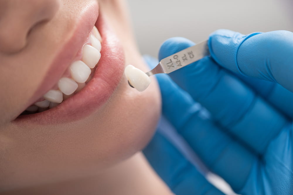 Dental crown situating near mouth of happy woman