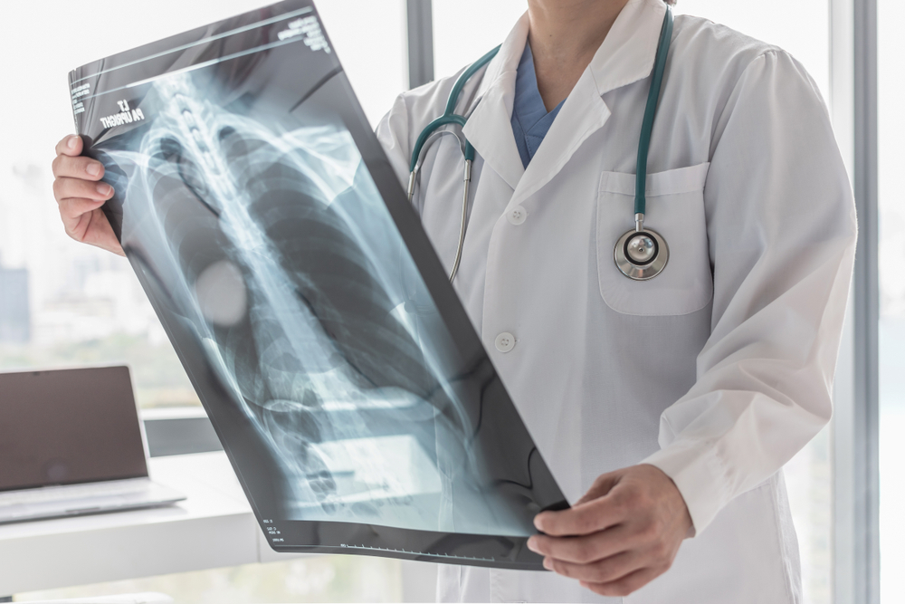 Doctor with radiological chest x-ray