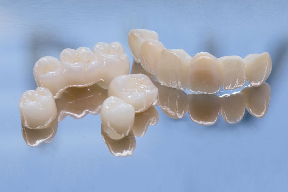 Metal Free Ceramic Dental Crowns. Ceramic Zirconium In Final Version.