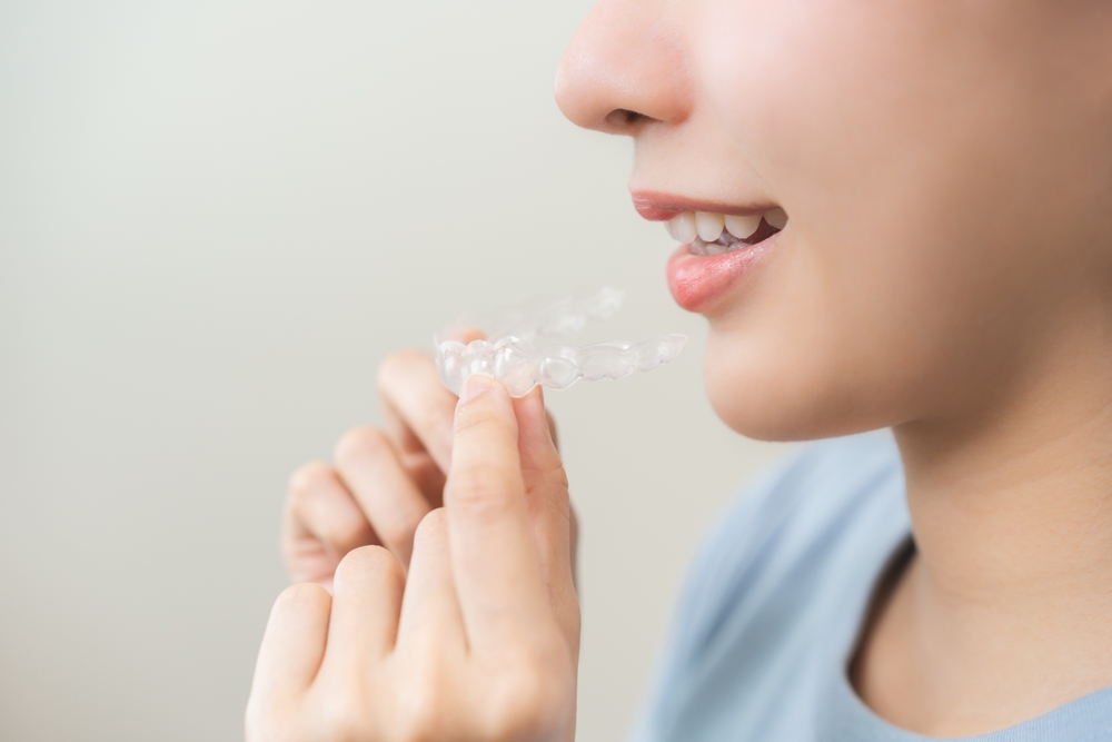 Common Invisalign Myths Debunked