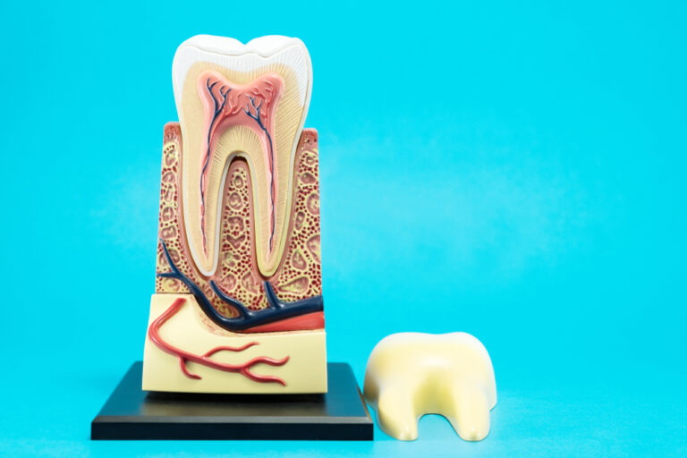 Understanding How Cavities Form