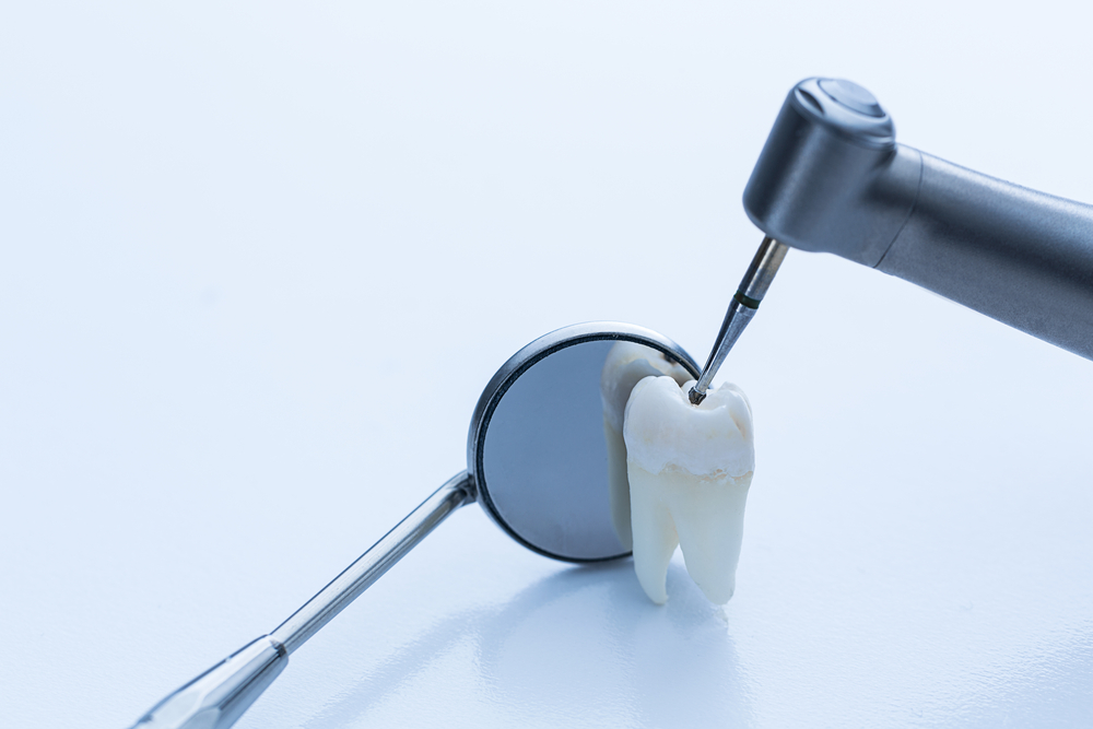 5 Reasons To Replace Metal Fillings