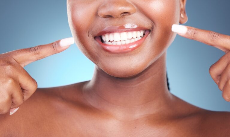 Teeth Whitening vs. Veneers For Stained Teeth