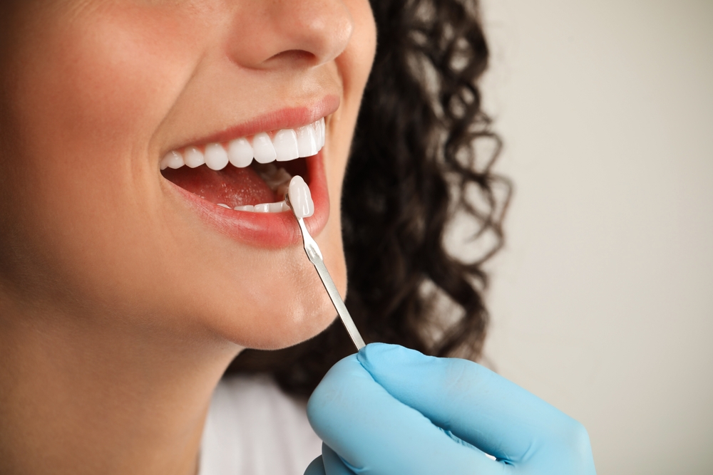 Cosmetic Dentistry How Veneers Can Improve Your Smile