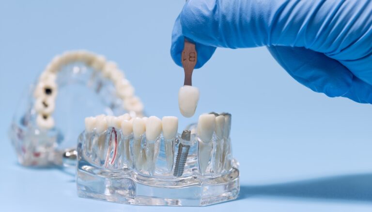 What to Expect During Dental Implant Surgery A Step-by-Step Guide