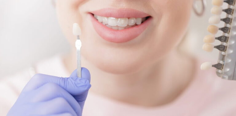 Female adult smiling while choosing dental veneer shade in dental clinic, stomatology concept.