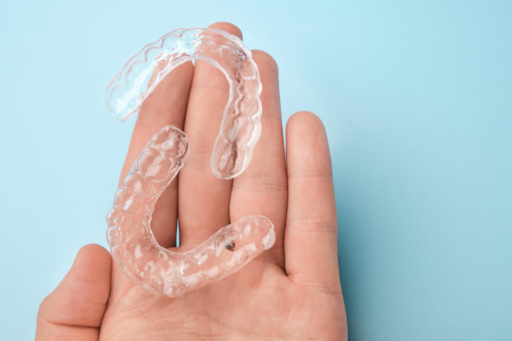 SureSmile Aligners