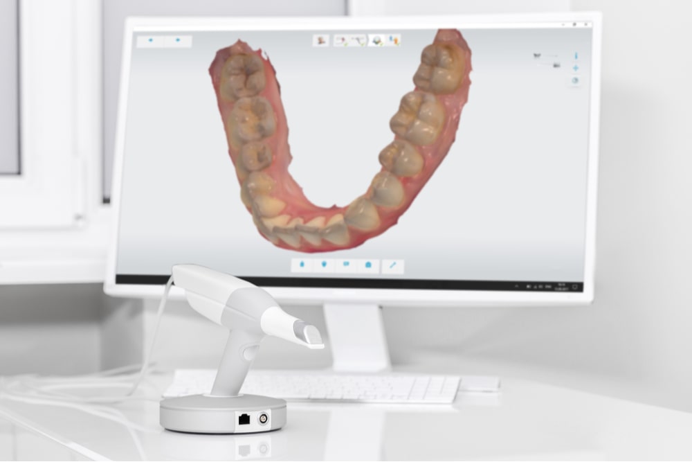 Dental 3d scanner and monitor in the dentist's office